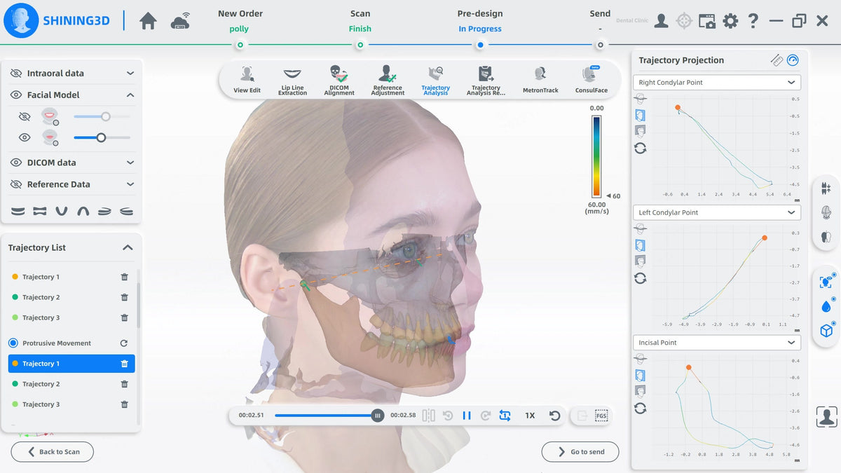 MetiSmile mandibular movement trajectory analysis software window