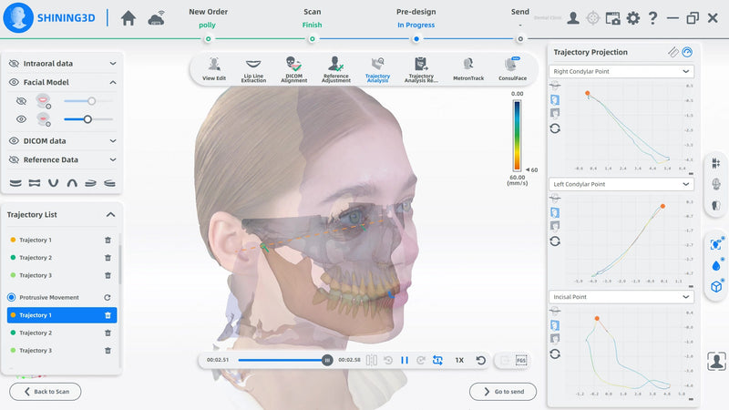Shining3D MetiSmile – Mandibular Movement Analysis Module