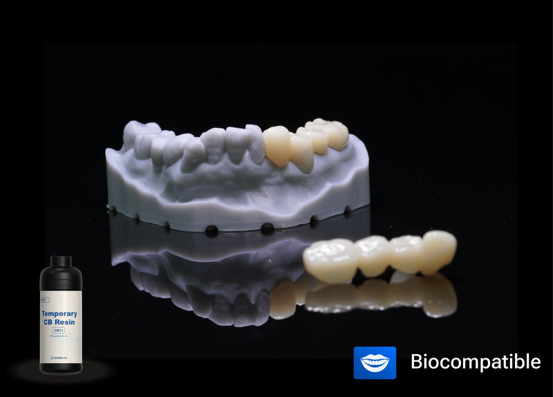 SHINING DENT CB11 – 3D Resin for Temporary Crowns and Bridges