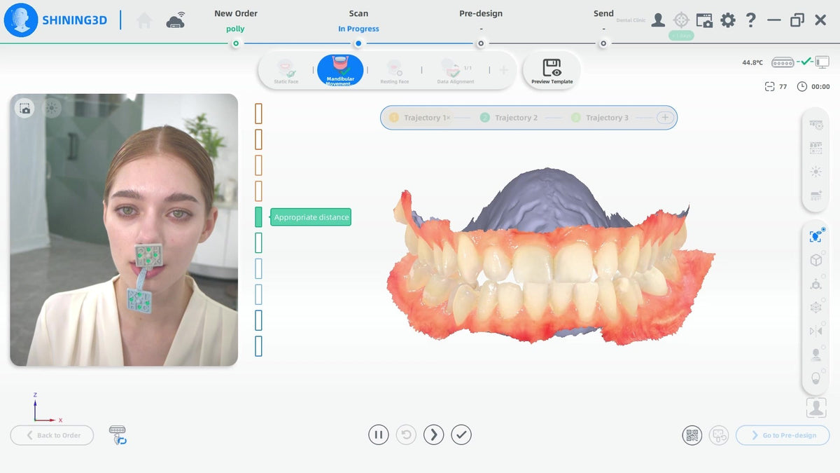 MetiSmile real-time jaw motion tracking