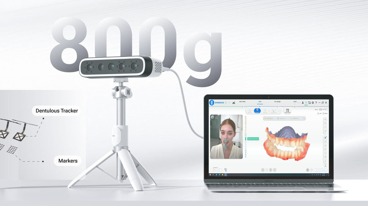 Shining 3D MetiSmile-MR face scanner on a tripod with jaw motion markers and computer