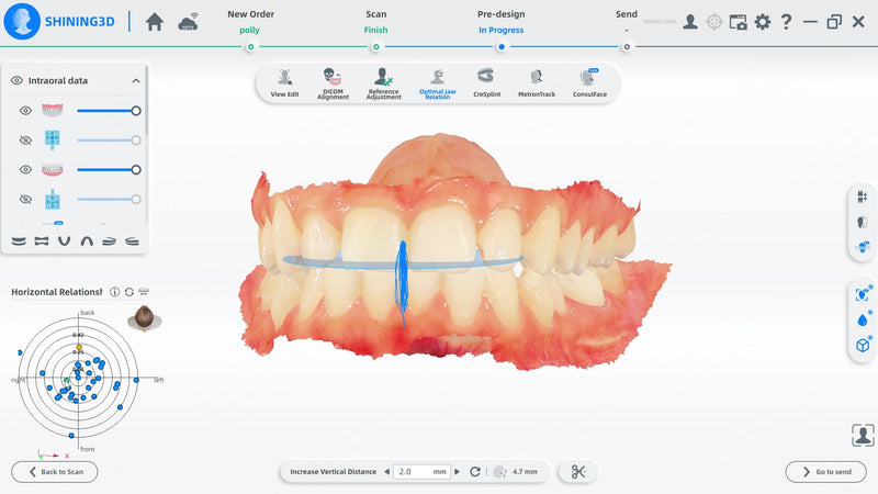 Shining3D MetiSmile – Optimal Jaw Relation Module