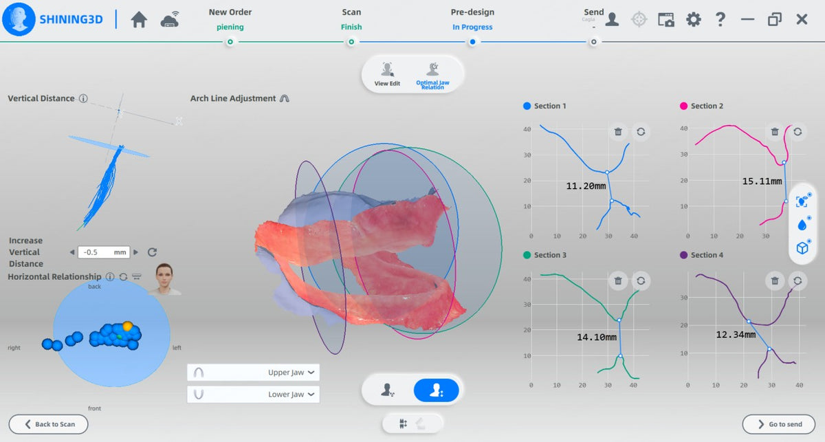 MetiSmile optimal jaw relation module analysis results window