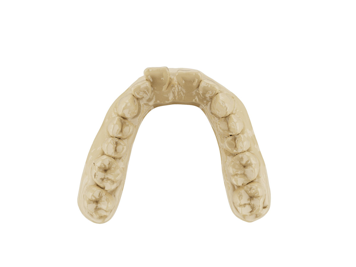 Orthodontic dental model printed in SHINING DENT OD02 resin