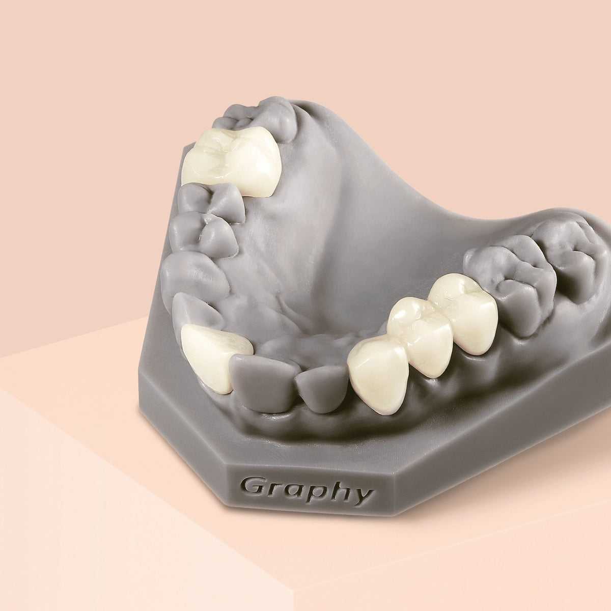 Crowns and bridges printed in Graphy Tera Harz TC-80DP resin, on a model