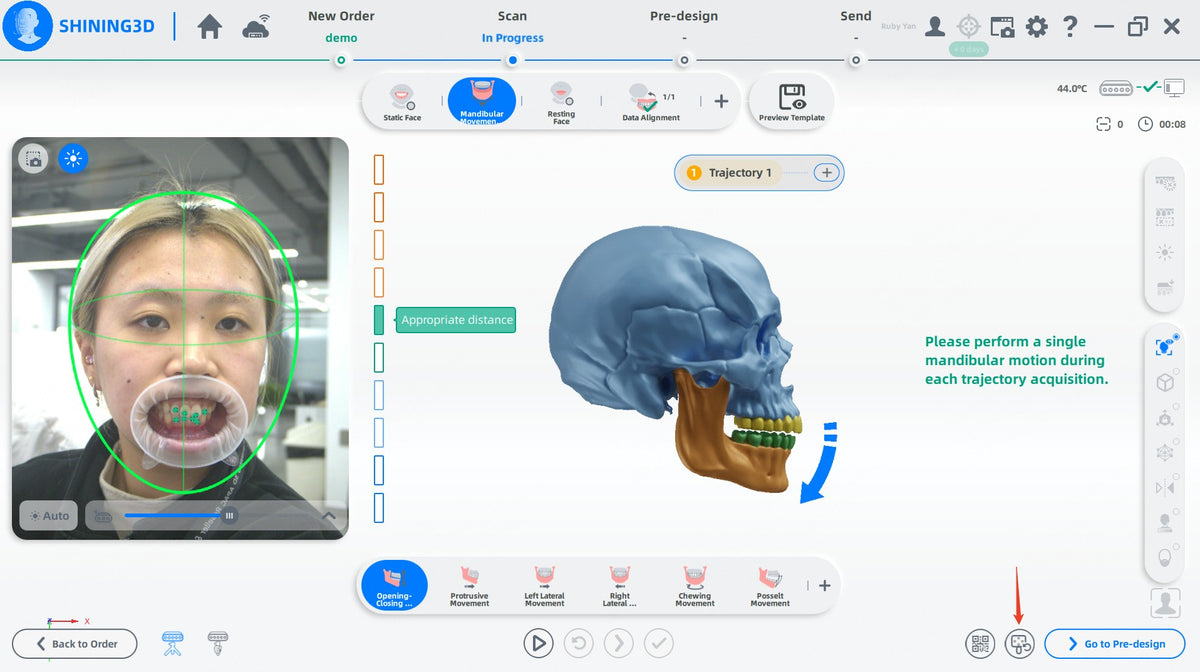 MetiSmile mandibular movement recording software window