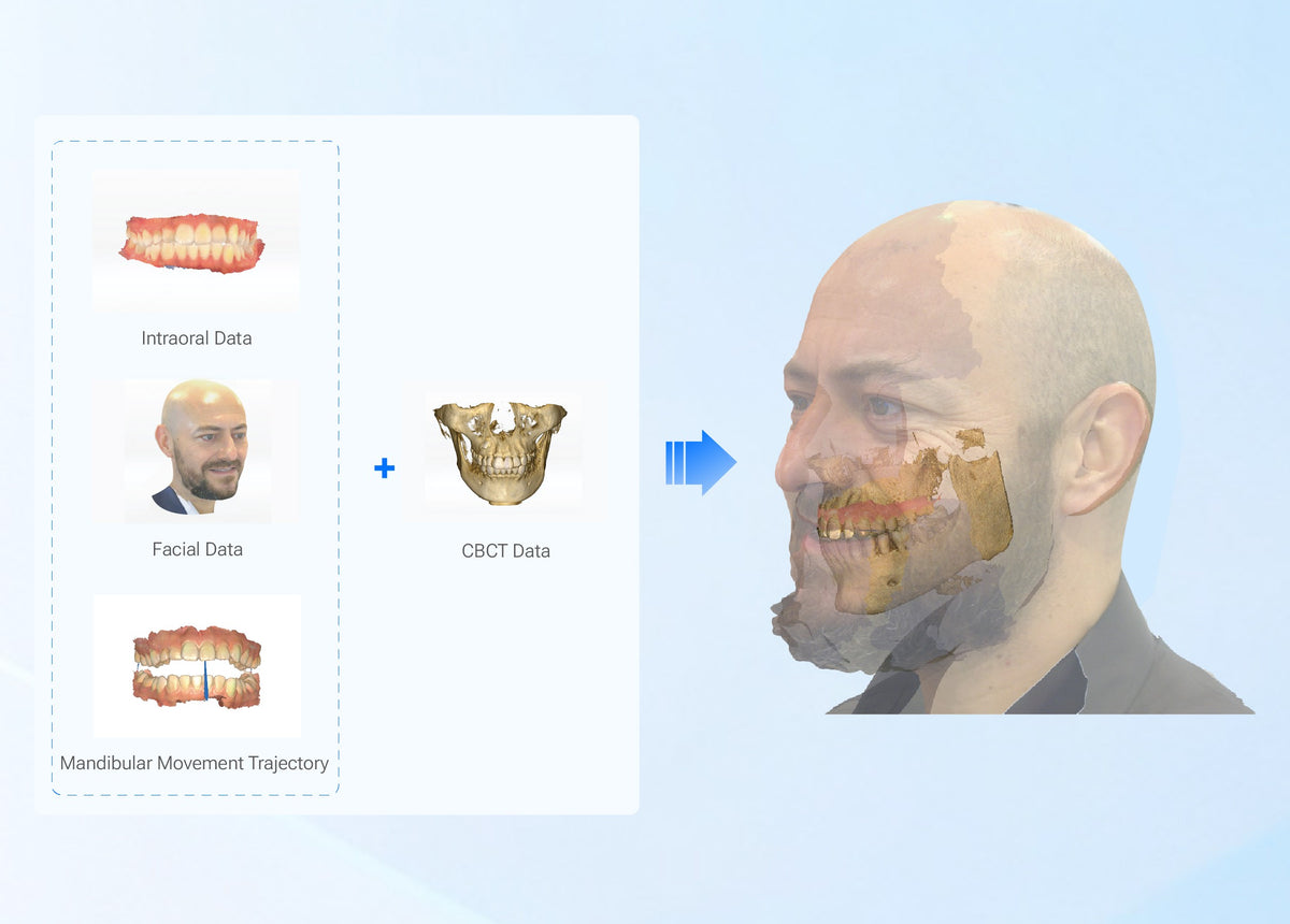 MetiSmile workflow: intraoral, facial, CT and jaw motion data