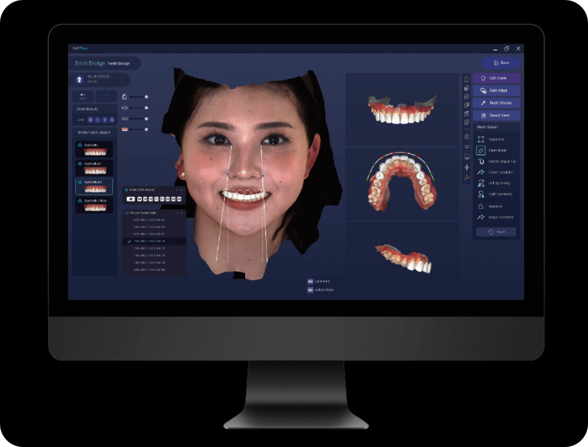 RAYFace software – 3D face model with dental scan data