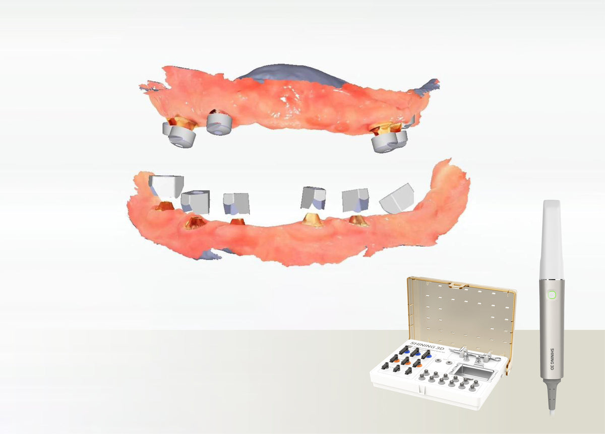 Aoralscan Elite with IPG kit and implant scan data