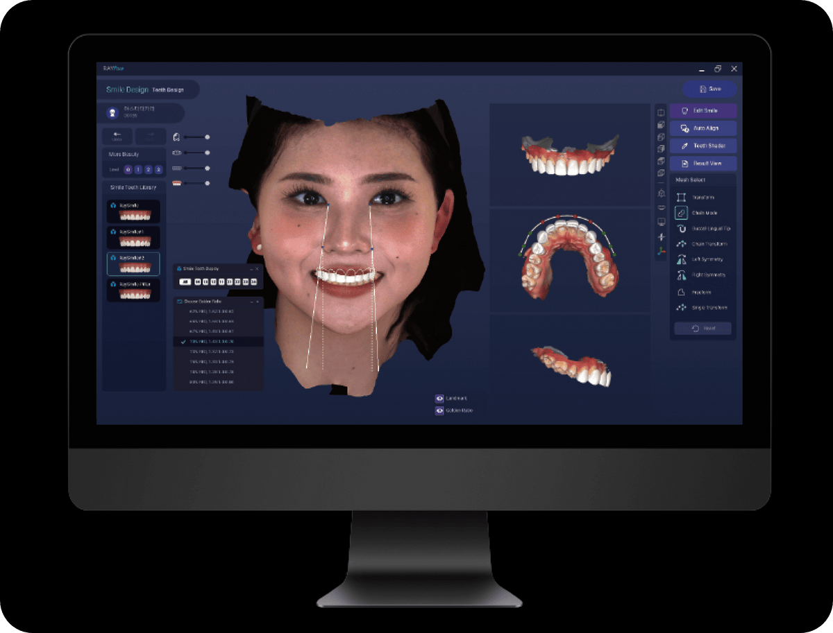 Digital Smile Design
